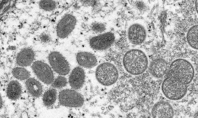 En el Estado de Paraná confirman 24 nuevos casos de viruela del mono