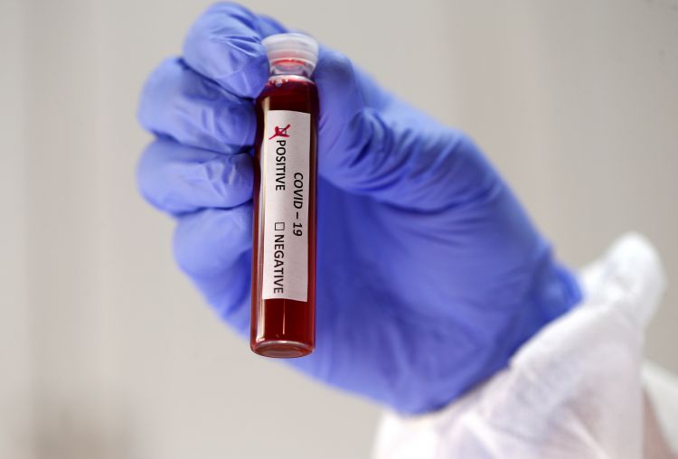 Salud reporta 18 muertes y 1.121 nuevos contagios de Covid-19