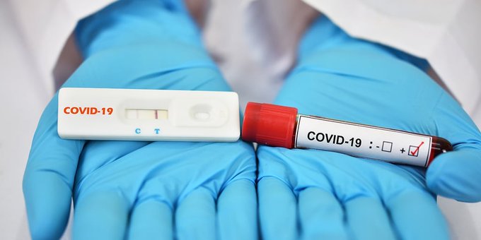 COVID-19: confirman más de 300 afectados en las últimas semanas