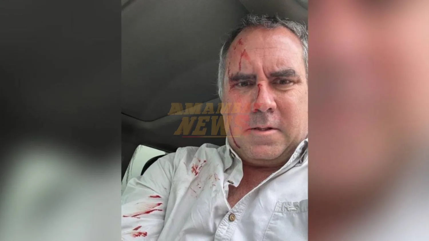 Atacan a tiros a candidato presidencial en Perú cuando viajaba en su automóvil