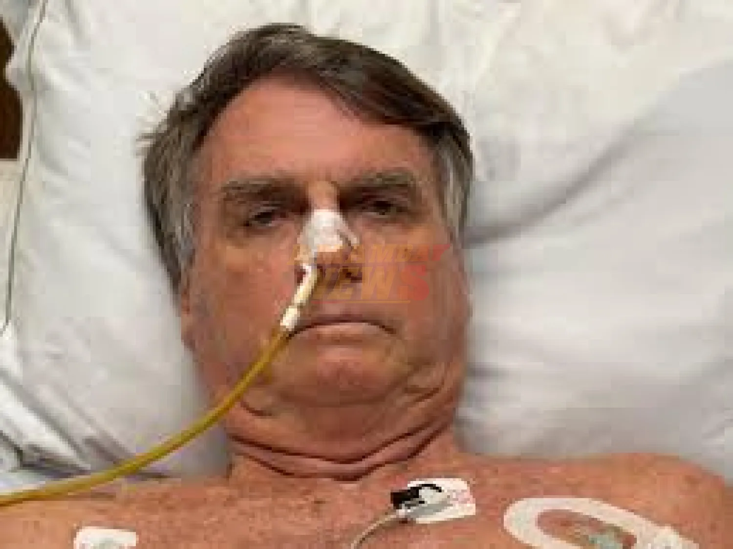 Descartan lesión grave de Bolsonaro tras caída en prisión