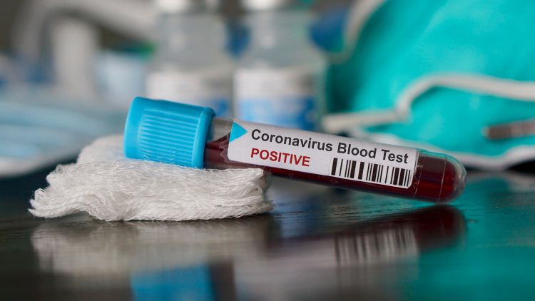 Suman 1.022 contagios y 17 fallecidos por coronavirus