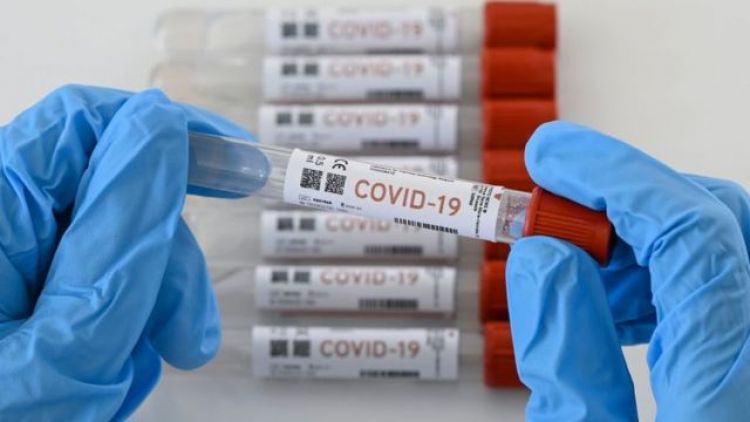 Llegaron 250.000 pruebas rápidas para detectar coronavirus en una hora