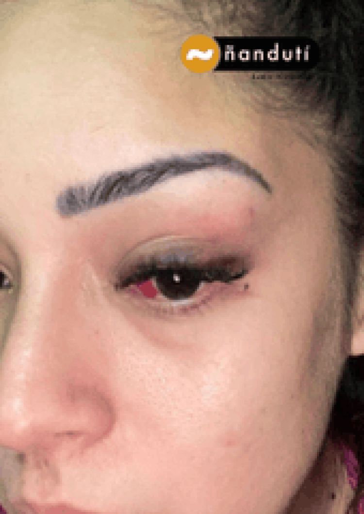 A una semana de brutal agresión a mujer, Fiscalía no imputa al supuesto autor