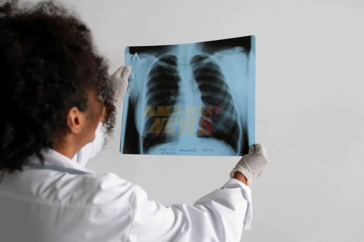Alarmante: INERAM detecta 4 a 5 nuevos casos de cáncer de pulmón cada semana