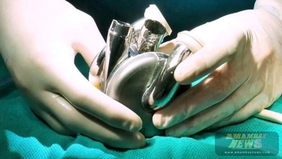 Implantan en un paciente el primer corazón artificial de larga duración del mundo
