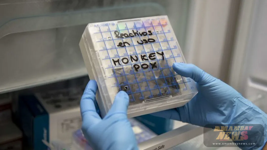 Pakistán detecta el primer caso de viruela del mono (mpox) este año