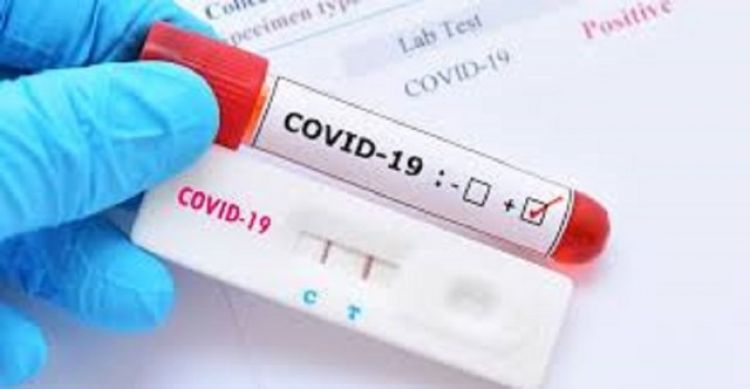 Salud Pública registra 74 casos y 1 fallecido por Covid-19