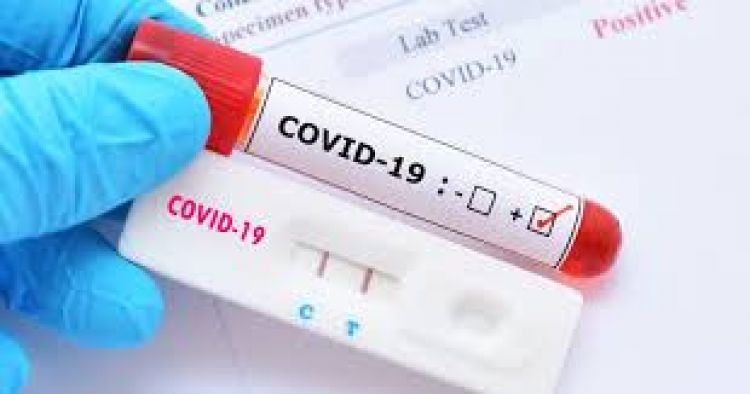 Focem destina a Paraguay otros US$ 150.000 para compras de test de COVID-19
