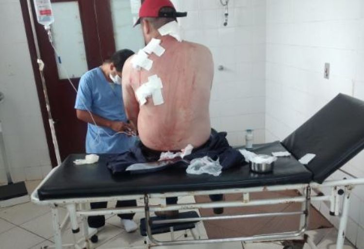 Brasileño es víctima de atentado en Capitán Bado