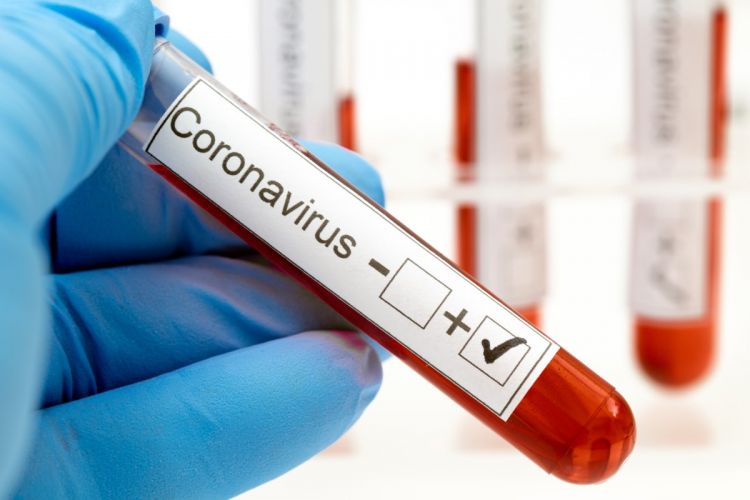 Reportan 18 muertes y 707 nuevos contagios por coronavirus
