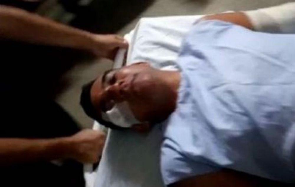 Polémico abogado 360 baleado de refilón por un desconocido