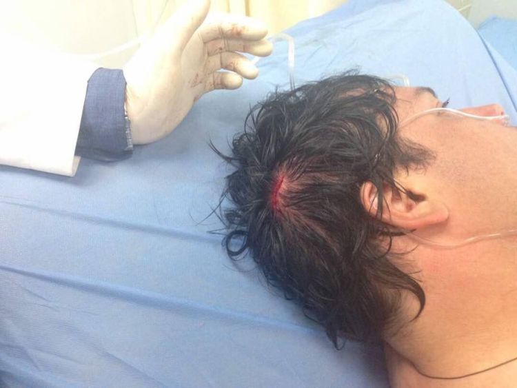 Hombre termina hospitalizado luego de ser atacado por su esposa con una botella