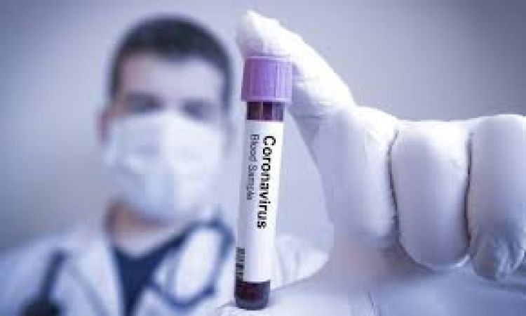 Confirman 448 casos de COVID-19 y 14 nuevos fallecidos