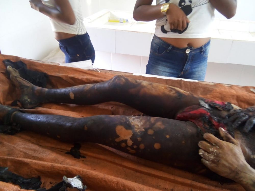 Hallan cuerpo parcialmente calcinado en Capitán Bado