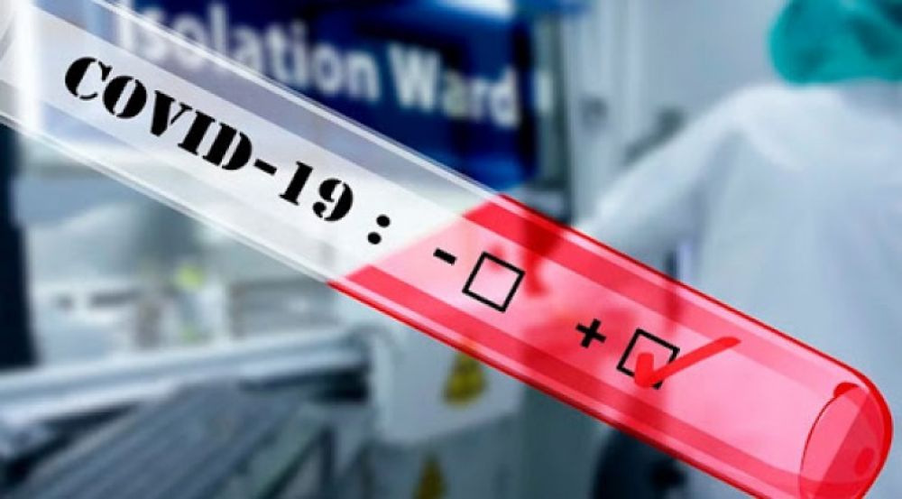 Salud da vía libre a laboratorios privados para realizar test de coronavirus