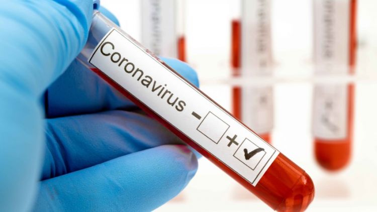 Marzo arranca con 974 nuevos contagios y 17 muertes