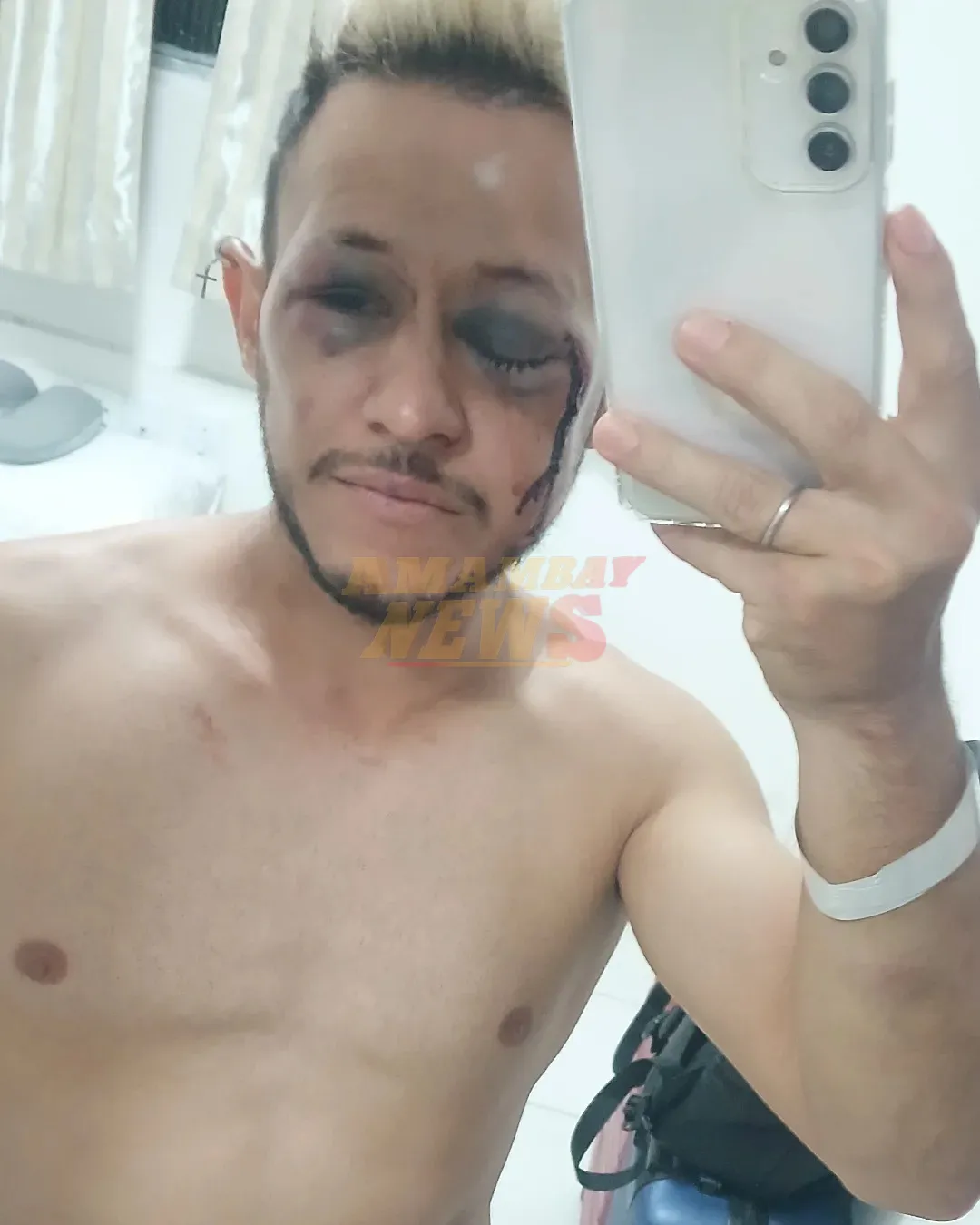Personal trainer agredido en playa brasileña alega haber sido víctima de ataque homofóbico