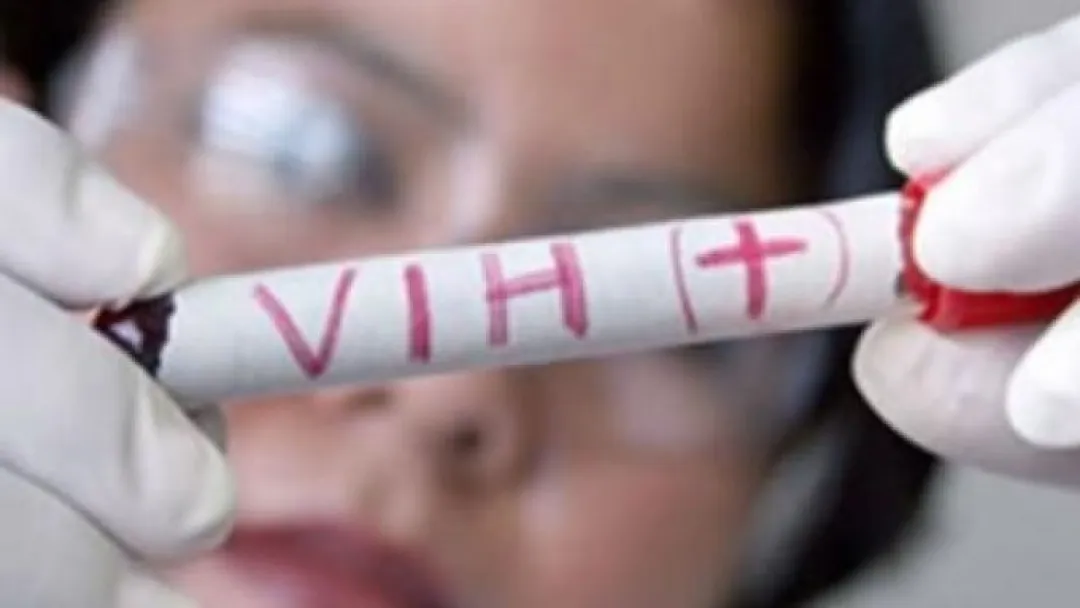 Científicos revelan nuevos datos sobre la relación entre el VIH y el sistema inmunológico