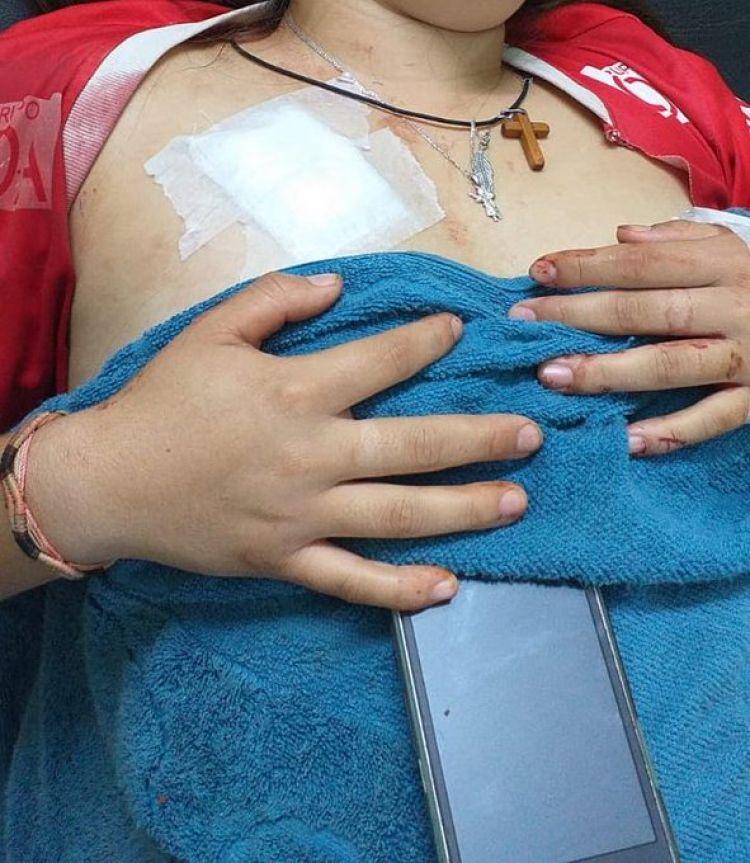 Reportan intento de feminicidio en Ñacunday