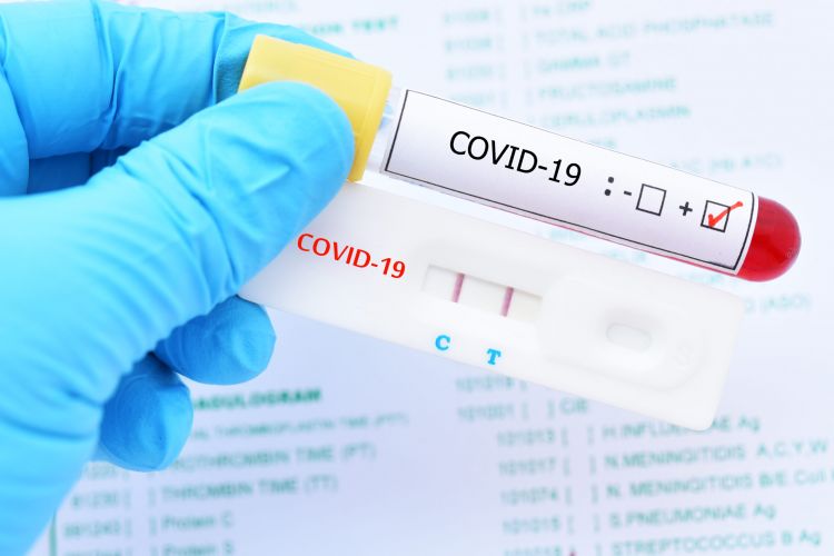 Salud reporta 10 nuevas muertes y 512 contagios de Covid-19