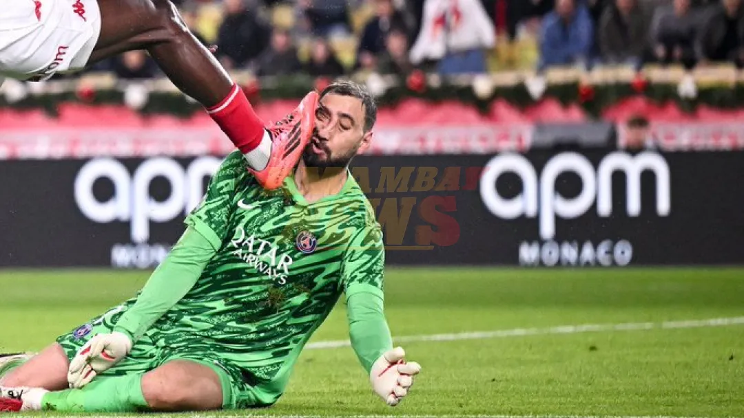 VIDEO: El portero del PSG recibe un fuerte plantillazo en la cara