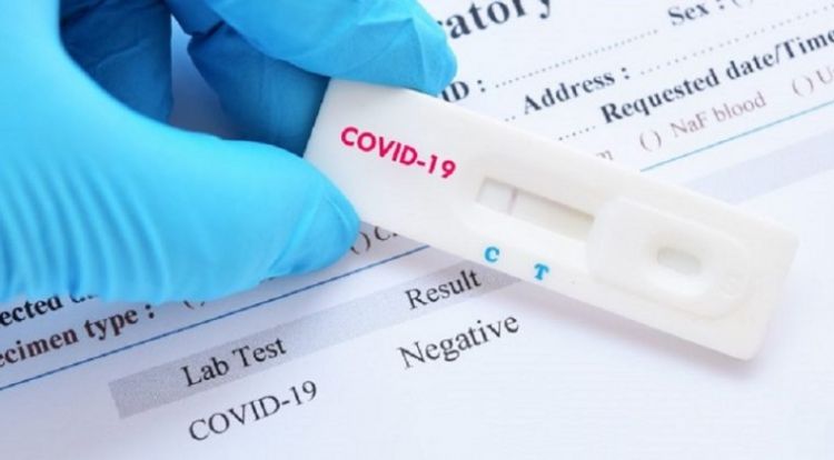 Con el sistema de salud más precario de la región, Paraguay avanza en cantidad de test por día