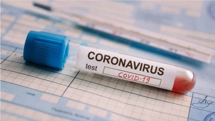 Salud informa de 754 nuevos casos y 13 muertes por coronavirus
