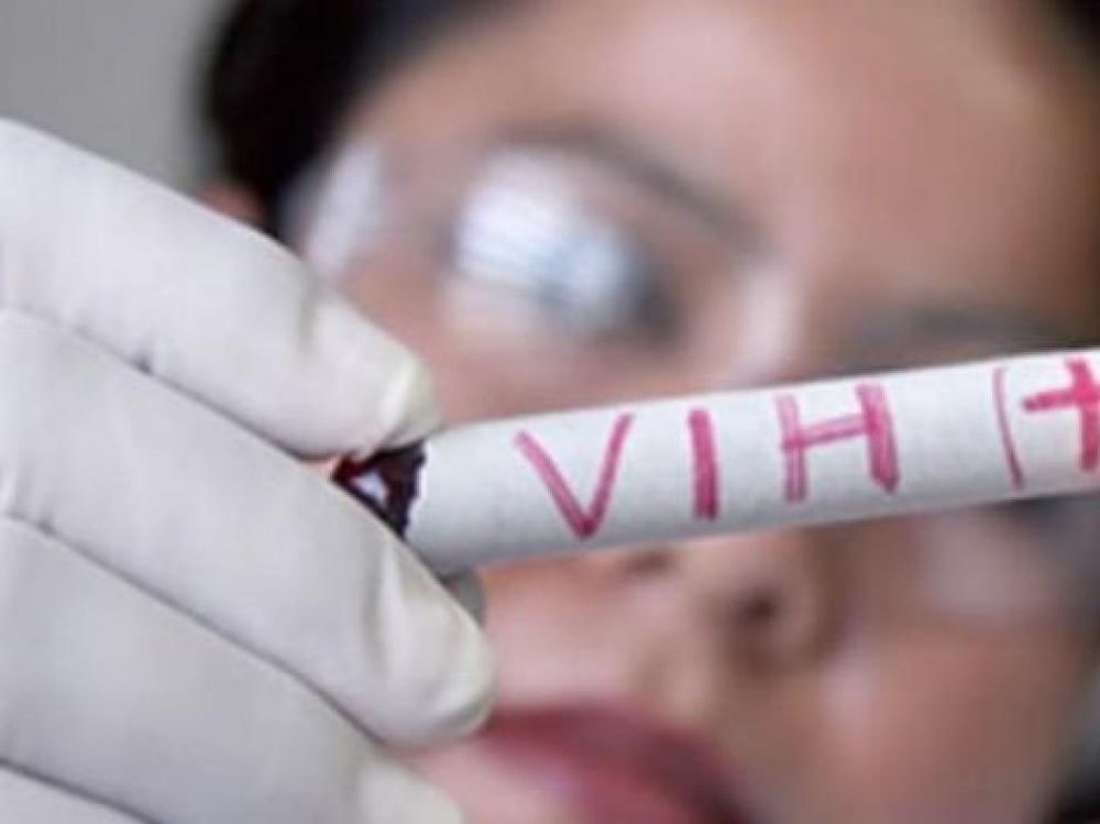Segundo caso mundial de curación de un paciente con VIH