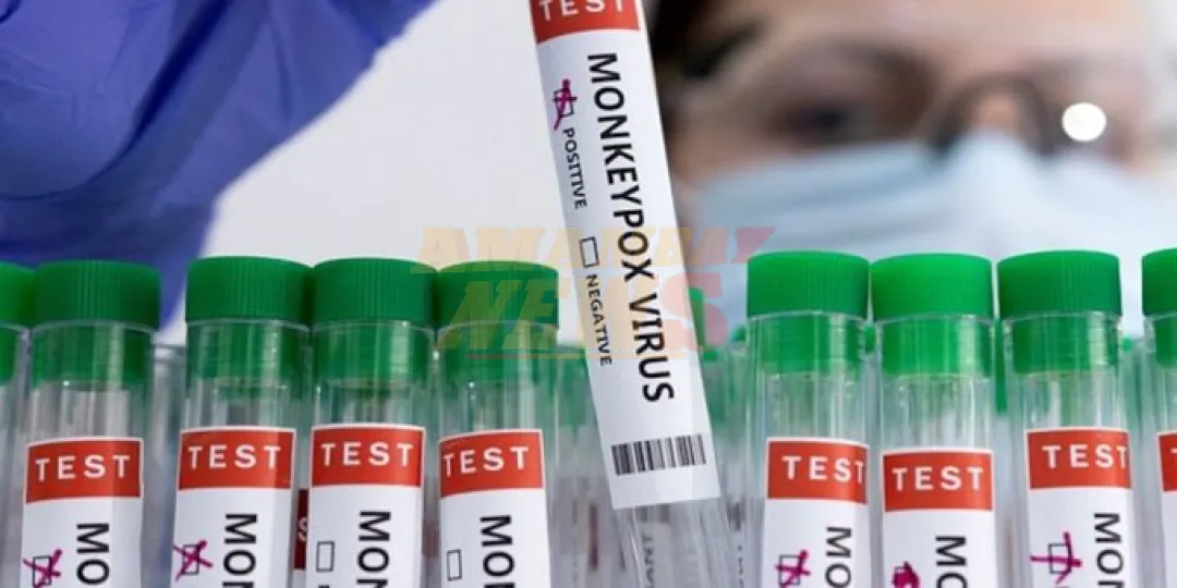 OMS aprueba la segunda vacuna contra la viruela símica