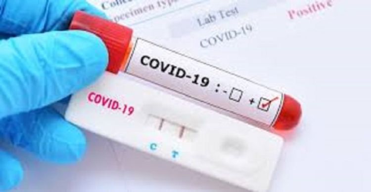 Salud registra 1.880 contagios y 59 muertes por Covid-19
