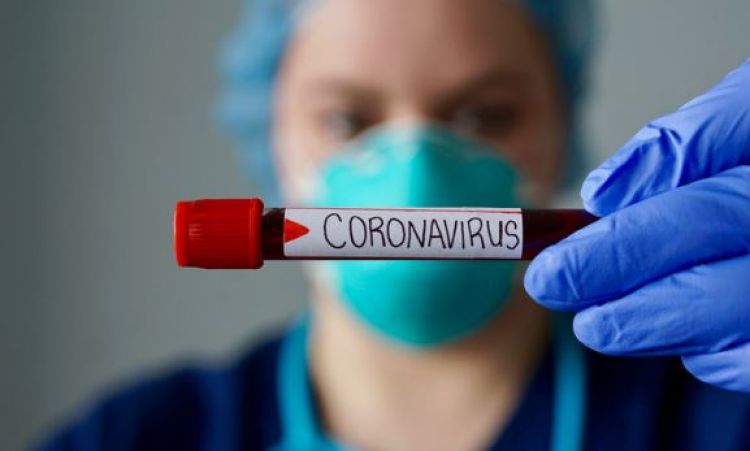 Salud informa sobre 812 nuevos contagios por Covid-19 y 13 muertes