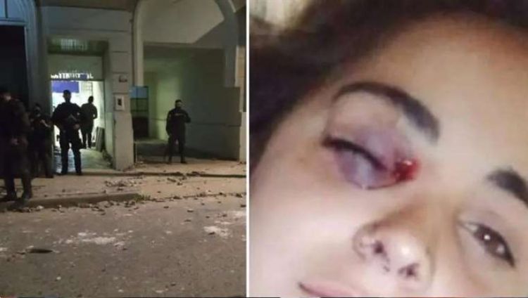 Joven casi pierde el ojo en protesta contra la muerte de rsula, en Argentina