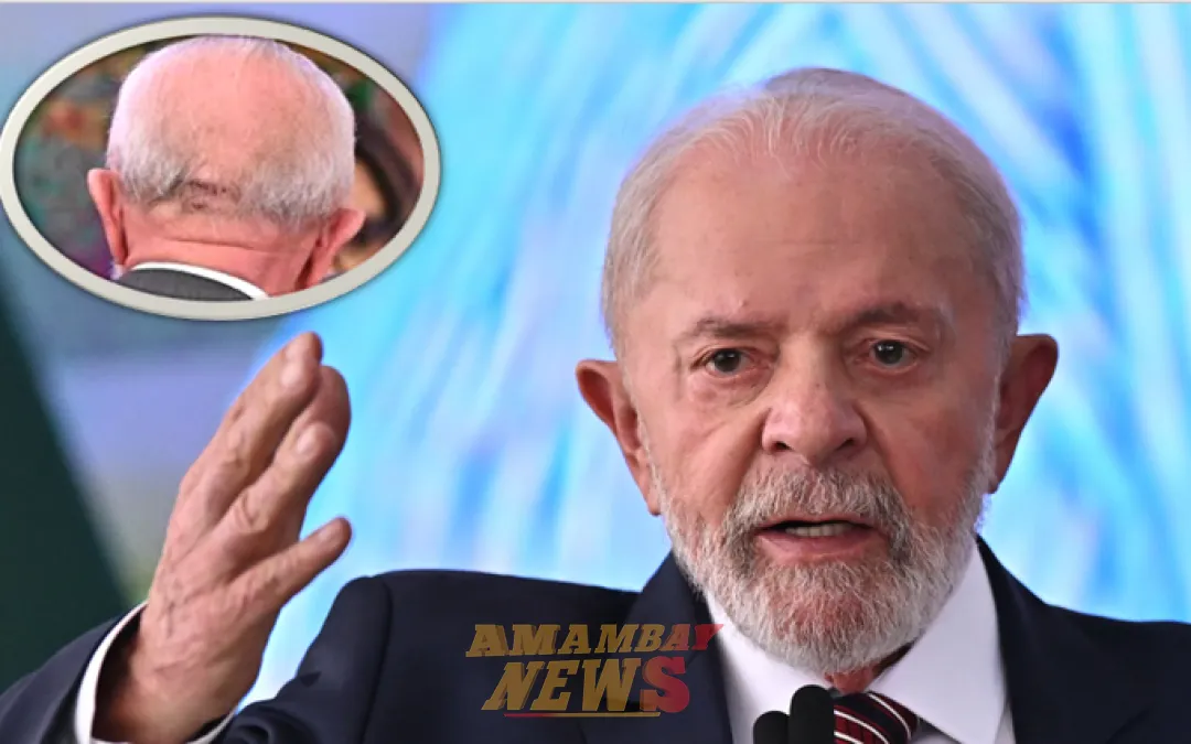 Lula continúa estable tras el golpe en la nuca y repetirá exámenes médicos en una semana
