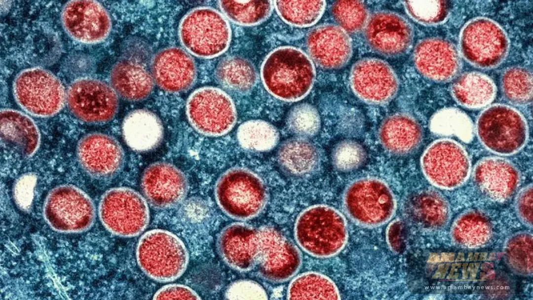 La OMS advierte que es probable que haya más casos de viruela del mono en Europa en los próximos días y semanas