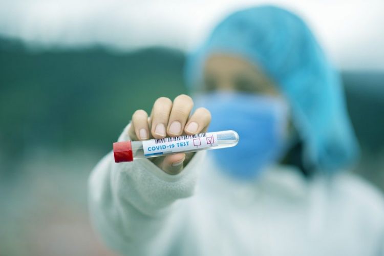 Salud informa sobre 24 muertes y 621 contagios por coronavirus