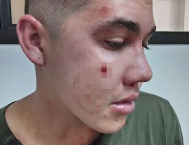 Militar citó a su camarada a su casa y lo recibió con un disparo en la cara