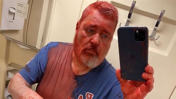 Dmitry Muratov: atacan con pintura roja en Rusia al Premio Nobel de la Paz y opositor a Putin