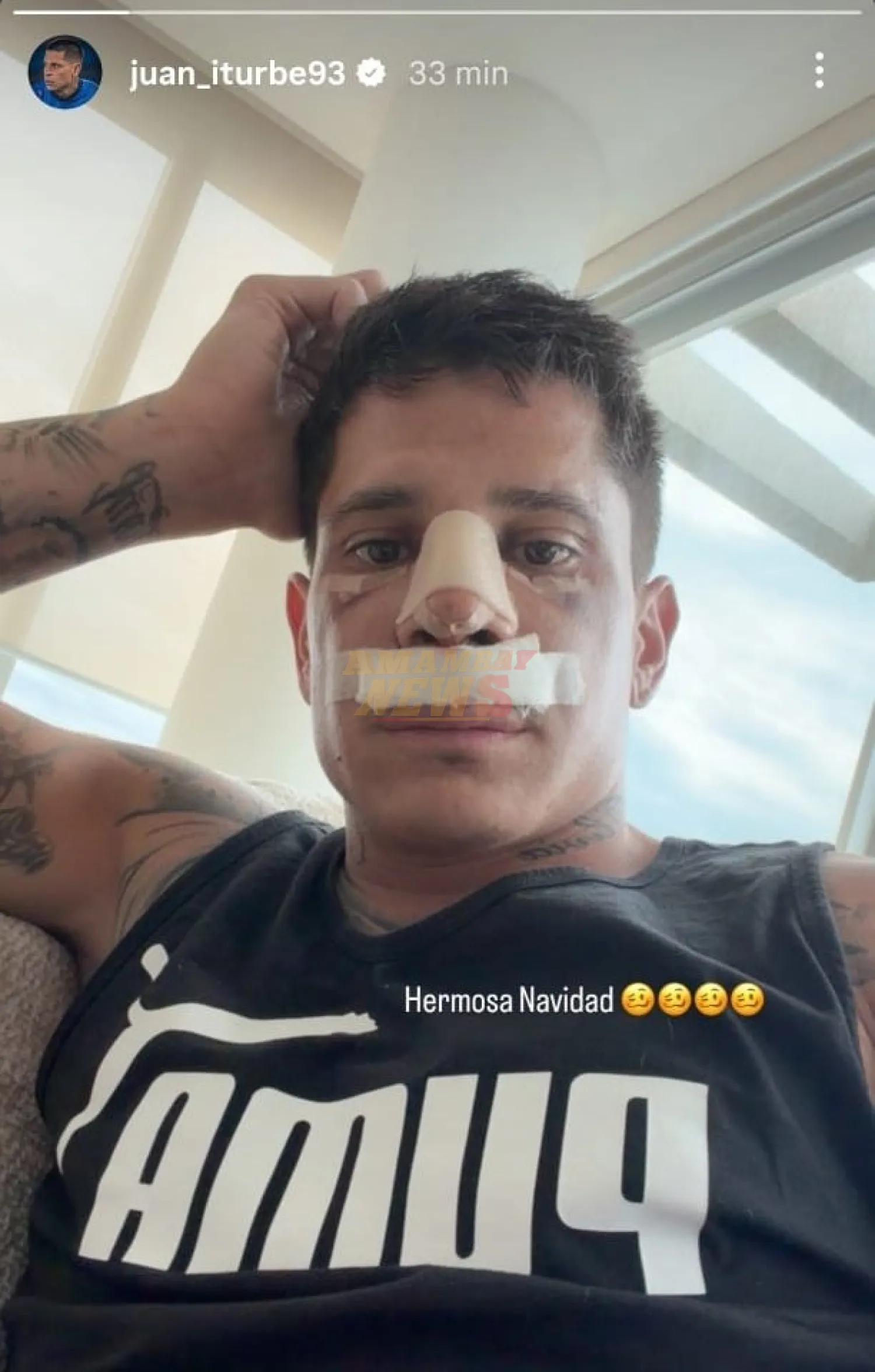 Iturbe y una exitosa cirugía de tabique nasal