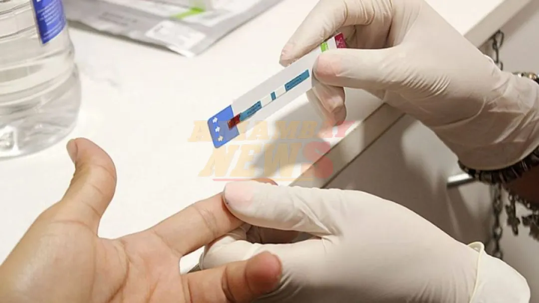 Plantean que chequeo de salud incluya el test para detectar VIH