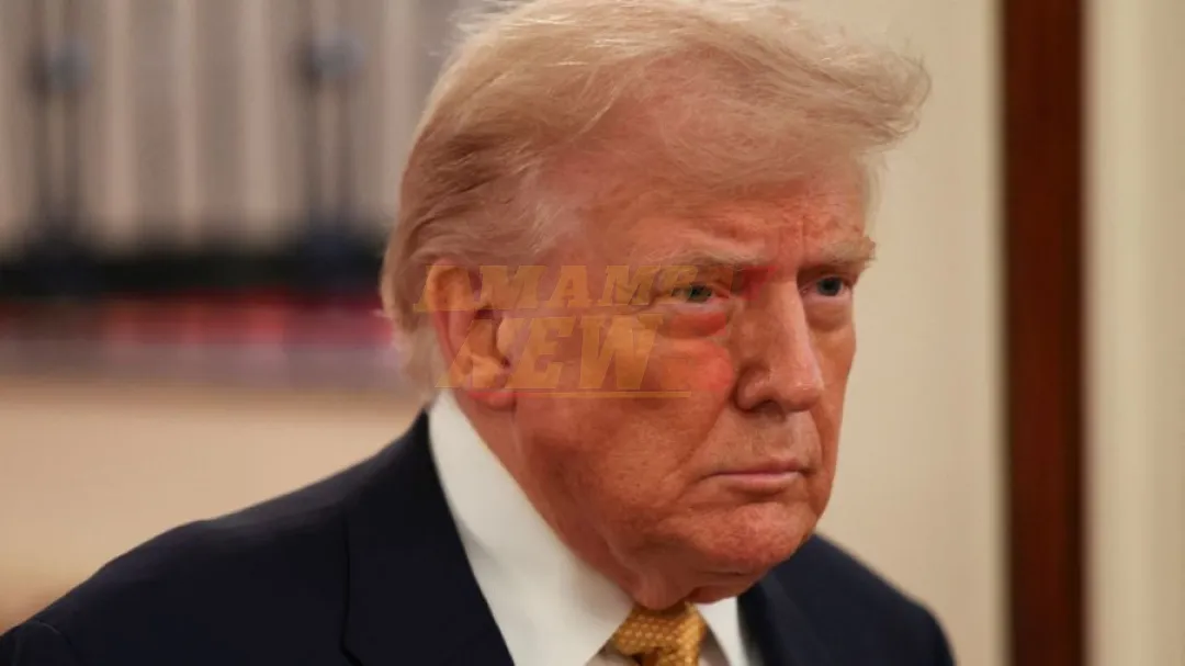 Salud de Trump: le diagnostican insuficiencia venosa crónica tras hinchazón de piernas y moretones en manos