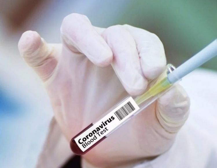 Covid-19: Salud Pública informa sobre 1.028 nuevos contagios y 19 muertes