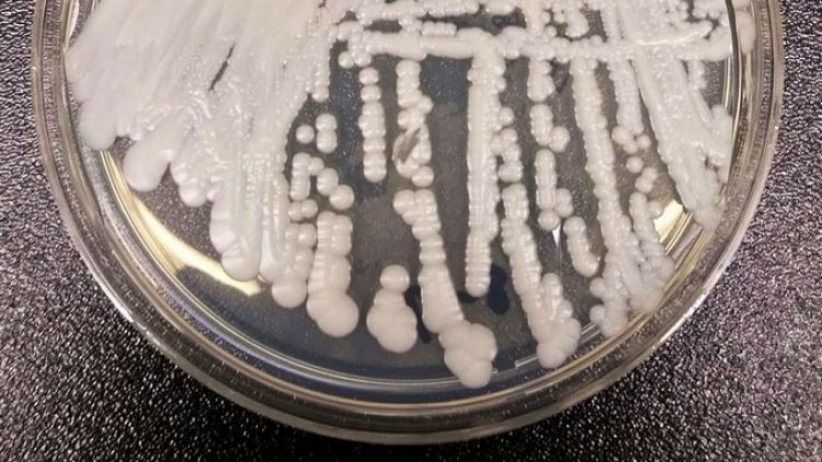Brasil reporta su primer posible caso de infección con el peligroso hongo Candida auris