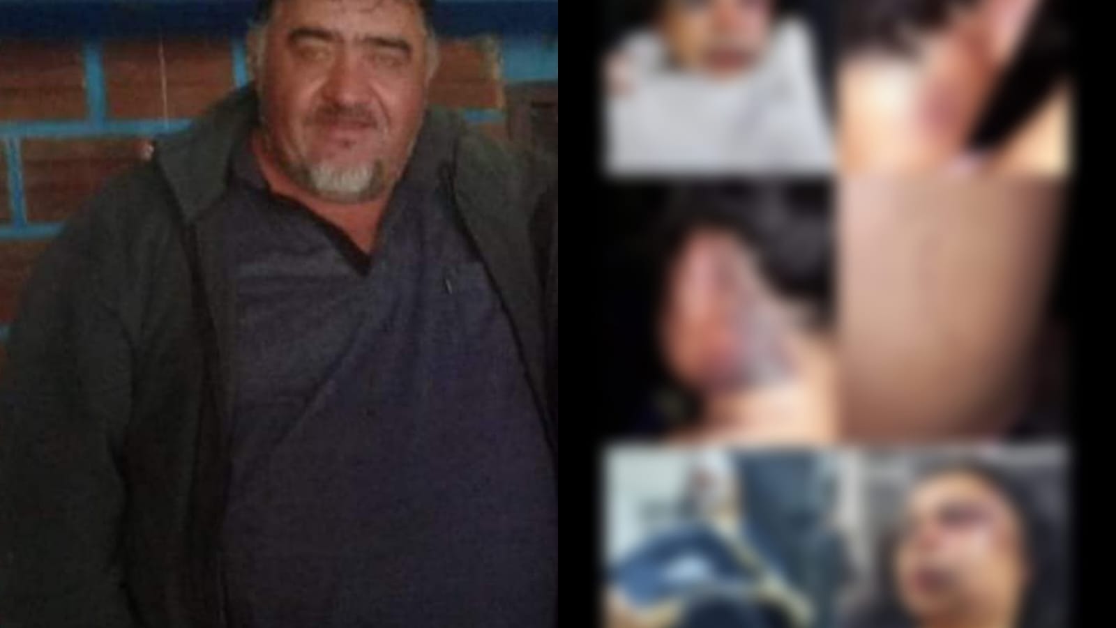 Solicitarán captura internacional de hombre que golpeó brutalmente a su expareja