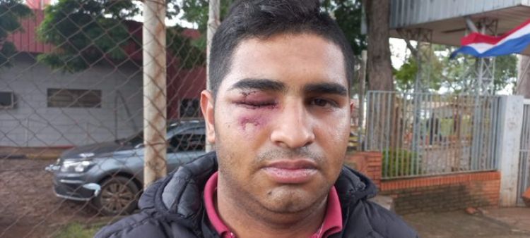 Joven pierde un ojo tras agresión en fiesta de San Juan en seccional colorada de CDE