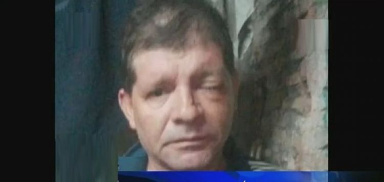 Ladrón casi lo deja tuerto tras golpearlo con varilla de hierro