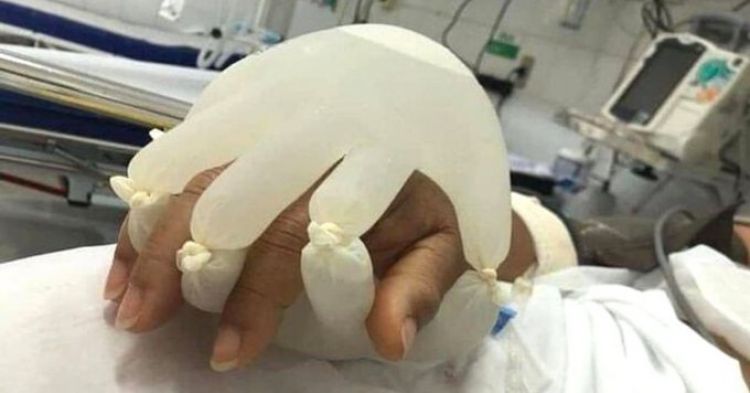 "La mano de Dios": la tcnica de una enfermera para dar consuelo a los pacientes con COVID-19