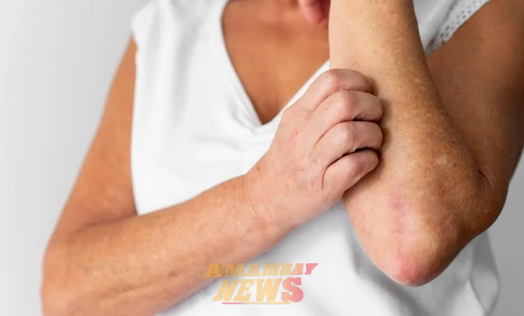 Día Mundial de la Psoriasis: avances y esperanza para pacientes