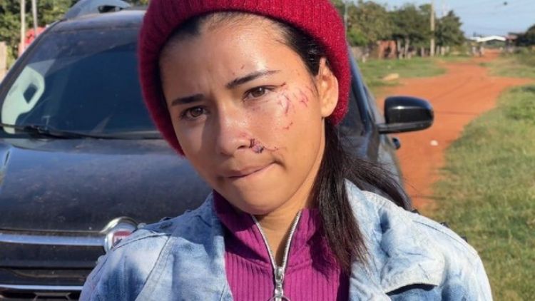 Motochorros golpean a una mujer con una botella en asalto en Concepción
