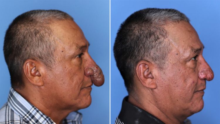 Un cirujano plástico le regala una reconstrucción facial a un obrero que trabajaba en su casa